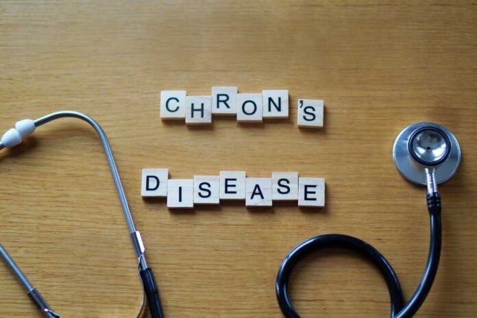 shutterstock_2515892963.jpg Wooden letter blocks spelling 'Crohn's Disease' next to a stethoscope