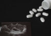 Live Abortion Party OUTRAGES Thousands Ultrasound printout beside scattered white pills and an open bottle