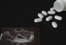 Ultrasound printout beside scattered white pills and an open bottle