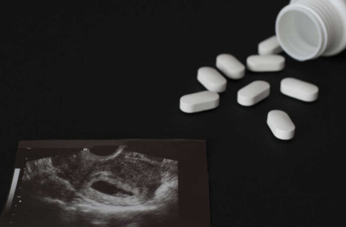 Ultrasound printout beside scattered white pills and an open bottle