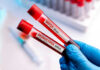 Virus Vials Found During Airport Inspection Two test tubes labeled MPox and Monkeypox.