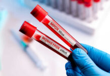 Virus Vials Found During Airport Inspection Two test tubes labeled MPox and Monkeypox.