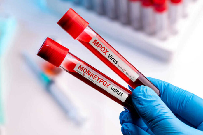 Two test tubes labeled MPox and Monkeypox.