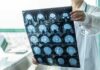 Scientists Edge Closer To Detecting CTE In Living Patients Doctor holding brain MRI scan film