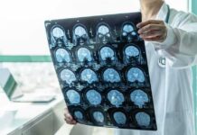 Doctor holding brain MRI scan film